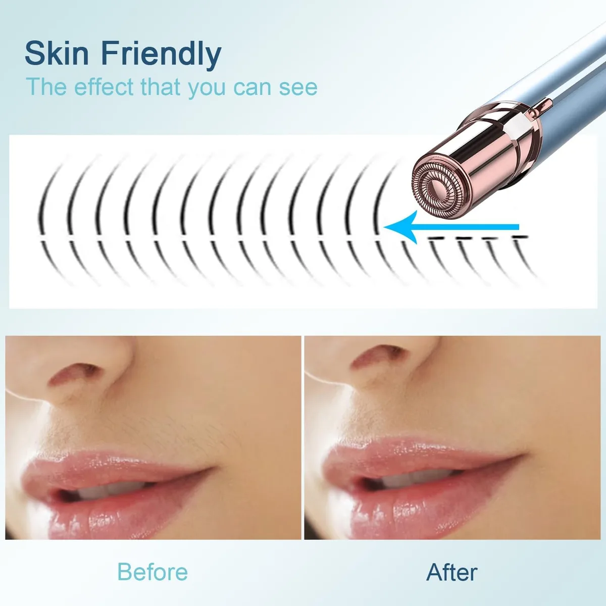 painless facial hair remover on the upper lip, before and after